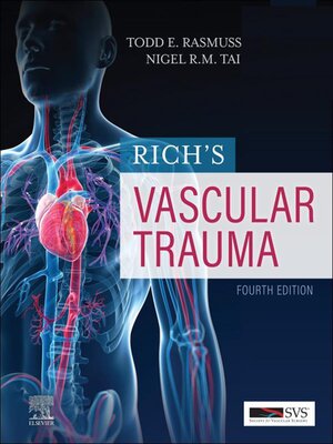 cover image of Rich's Vascular Trauma E-Book